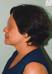 Fig. 2 – Fotografia inicial, perfil